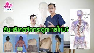 จัดกระดูกสันหลังแก้อาการกระดูกสันหลังคดได้จริงหรือไม่  | ตอบคำถามกับบัณฑิต EP.44