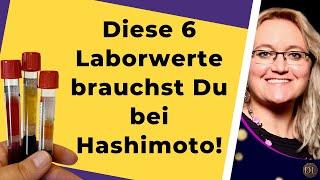 Diese Blutwerte sind bei Hashimoto wichtig! Laborwerte, Testergebnis, Schilddrüse