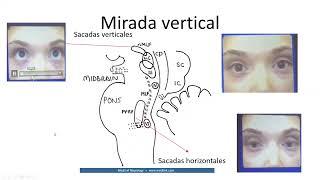 alteraciones de la mirada clase 3. Dr. Luis Ernesto González Sánchez