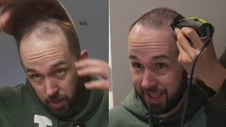 I'm Scared To Go Bald - Shaving My Head For The First Time