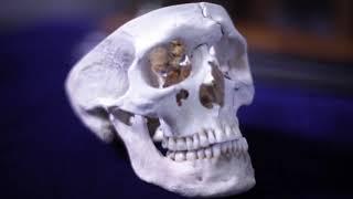 Phineas Gage