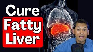 How to Cure Fatty Liver! | Lifestyle Changes to Help Reverse NAFLD