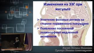 Электроэнцефалография при коморбидных состояниях