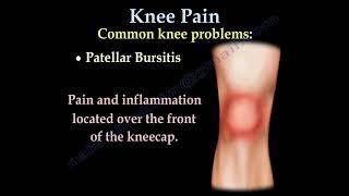 Knee Pain, causes, symptoms, diagnosis and treatment.