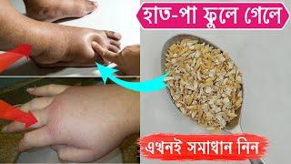 যত ফোলাই হোক ৫ মিনিটে হাত পা ফোলা চিরদিনের জন্য ভালো হয়ে যাবে। একবার ভালো হলে আর ফিরবে না