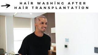 Hair washing after hair transplantation -  Now Hair Time