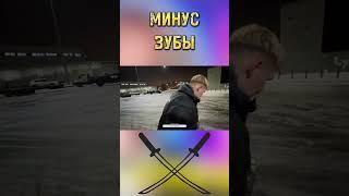 МИНУС ЗУБЫ