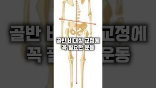 골반 비대칭 교정에 꼭 필요한 운동 #골반교정 #복사근