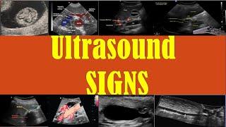 Top 50 ultrasound signs every radiologist should know!!