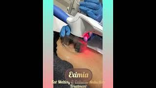 Eximia Slimming Treatment(non-invasive) - Fat Melting & Cellulite Reduction at Euromed® Clinic Dubai