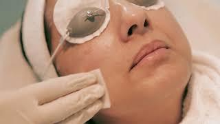 Mediskin Clinic Chemical Medical Peel testiminial from Pam