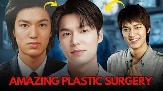 The BEST plastic SURGERIES performed by Korean ACTORS