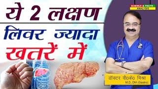 ये २ लक्षण लिवर ज्यादा खतरे में  || FATTY LIVER TWO WARNING SIGNS IN LEG AND ABDOMEN