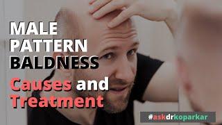 Male Pattern Baldness - Causes & Treatment | Ask Dr. Koparkar