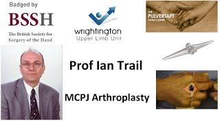 MCPJ Arthroplasty by Prof Ian Trail