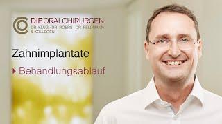 Zahnimplantate - Behandlungsablauf (Dr. Daniel Klug)