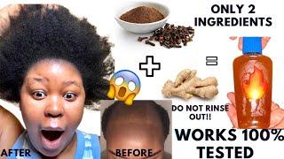 WOW I’M STILL SHOCKED |Your Hair Won’t Grow? Try This Recipe For EXTREME Hair Growth Now!!! #garlic