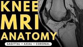 Knee MRI Anatomy | Radiology anatomy part 1 prep | How to interpret a knee MRI