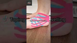 Help your ankle heal faster! Kinesiology Taping Technique  #pain #ankle #sprain