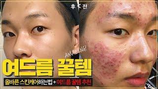 인생템만 추려옴!! 여드름 스킨케어 추천( 여드름 없애는 방법 + 올바른 스킨케어하는법 ) l 화니HWAN’E