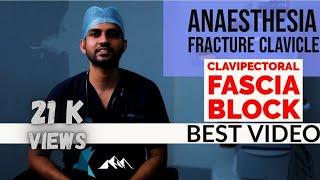 CLAVIPECTORAL FASCIA PLANE BLOCK / REGIONAL ANAESTHESIA FOR CLAVICLE FRACTURE CLAVICLE SURGERY