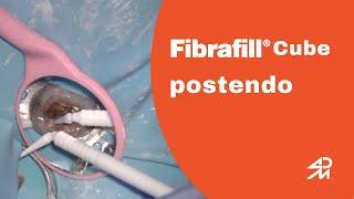 Fibrafill Cube Postendo