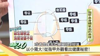 指甲上有白斑 可能黴菌感染？「指甲」隱藏疾病徵兆 健康2.0