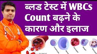 High Wbcs Count In Blood | ब्लड में WBCs बढ़ने के कारण और इलाज | High Wbc Count Treatment In Hindi