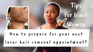 What to expect before and after a laser hair removal appointment |tips for black skin.