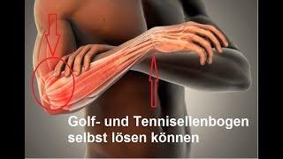 schnelle Selbsthilfe bei Golferarm & Tennisellenbogen - Epicondylitis