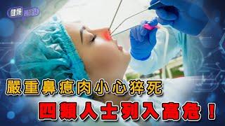 嚴重鼻瘜肉小心猝死 四類人士列入高危！ ｜ 健康關注組 ｜ EP346 ｜ 鼻瘜肉 ｜ 鼻敏感 ｜ 鼻竇炎 ｜ 敖嘉年 ｜ 朱智賢 ｜ HOY TV 77台