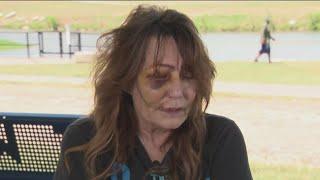 Woman recounts altercation with Fort Worth officers, says she has bruises "everywhere"