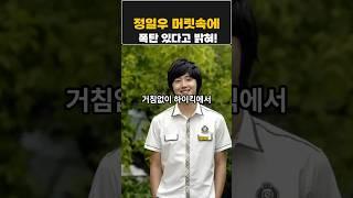 정일우 머릿속에시한폭탄이??#정일우
