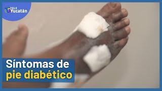 Síntomas de PIE DIABÉTICO | VIDEOS de prevención y cuidados 2022 | TELE Yucatán