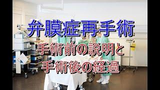 ７年目の再手術　大動脈弁置換術　生体弁再手術　術前の説明と術後の経過