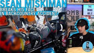 Sean Miskiman Breaks His Face In a Backcountry Accident | Bomb Hole Highlights