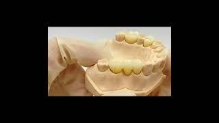 Vsmile factory Zirconia block Production