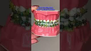 HOW TO FLOSS AND BRUSH YOUR TEETH WITH BRACES / BRACES JOURNEY TIPS  🪥