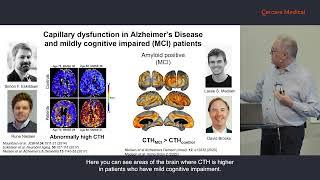 Leif Østergaard:  The Technology behind Perfusion Maps