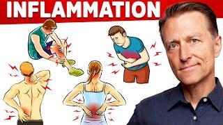 The #1 Best Remedy for Inflammation (Autoimmune, Gut, and Arthritis) That You Never Considered