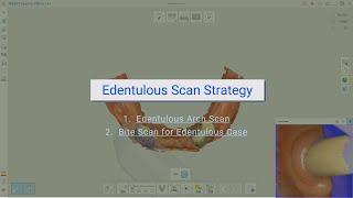 Edentulous Scan Strategy