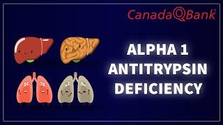 Alpha-1 Antitrypsin Deficiency