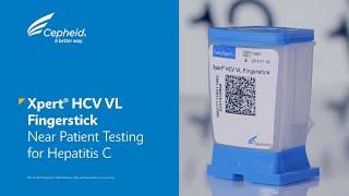 Xpert(R) HCV VL Fingerstick - Near Patient Testing for Hepatitis C