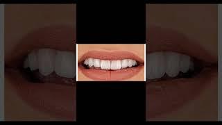 Dental Health Care | Dr. Wasif Rashid | Dentist | #foryou #shorts