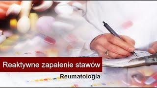 Reaktywne zapalenie stawów