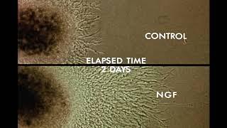 8.  Response of Cells to Nerve Growth Factor (NGF)