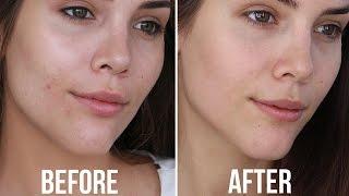 My Skincare Routine for Oily/Acne Prone Skin + 10 Minute Makeup Tutorial | Katerina Williams