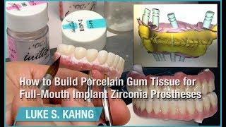 How to Build Porcelain Gum Tissue for Full-Mouth Implant Zirconia Prostheses