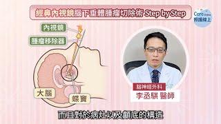 腦下垂體腫瘤警訊與經鼻內視鏡腦下垂體腫瘤切除手術