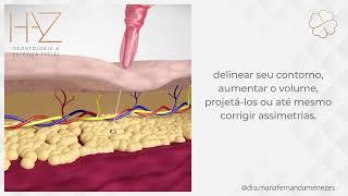 PREENCHIMENTO LABIAL - HARMONIZAÇÃO OROFACIAL - DRA MARIA FERNANDA MENEZES